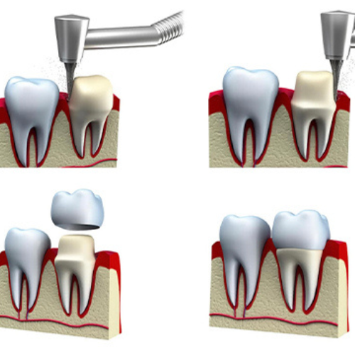 Aruvi Aesthetic Dental Clinic, Best Aesthetic & Dental Clinic, Hosur.