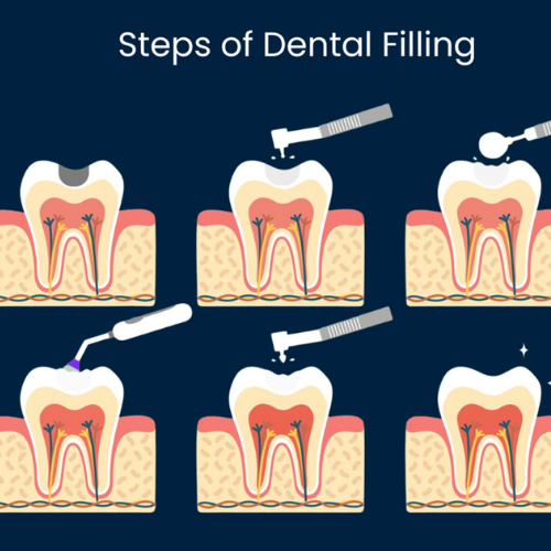 Best Aesthetic Dental Clinic in Hosur - Aruvi Aesthetic Dental Clinic