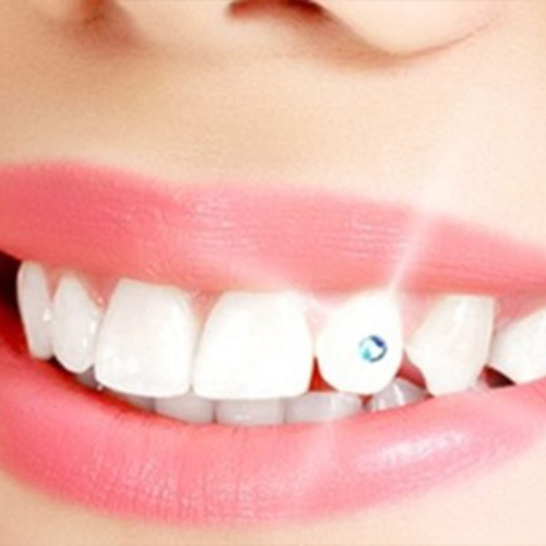 Best Aesthetic Dental Clinic in Hosur - Aruvi Aesthetic Dental Clinic