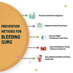 Bleeding gums prevention infographic from Aruvi Aesthetic Dental Clinic Hosur - practice good oral hygiene, regular dental checkups, right toothbrush/floss, quit tobacco, balanced diet & hydration for healthy gums.